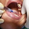 HMD Unolok Syringe 2.5ml | 24 Gauge | 1 Inch Needle2.5ml - Image 10